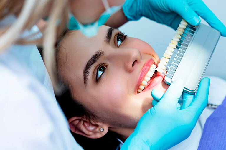 Descubrí lo último en blanqueamiento dental: seguridad y métodos